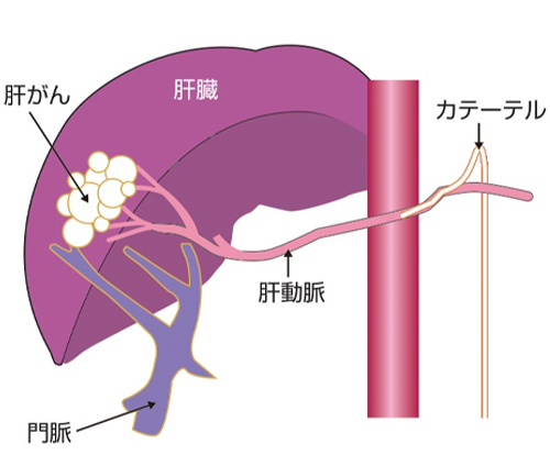 固有肝動脈