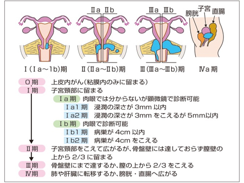 子宮きゅん