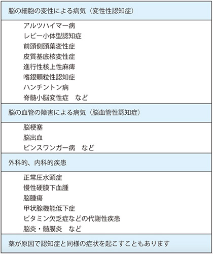 アルツハイマー 型 認知 症 と は