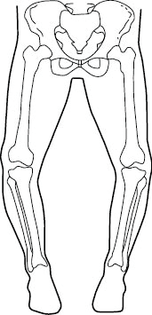 O脚の人は膝を傷めやすい