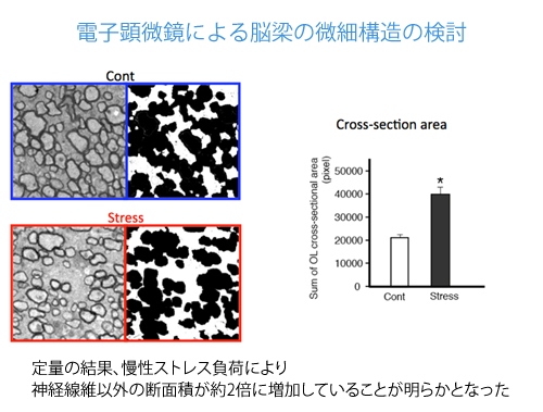 電子顕微鏡による脳梁の微細構造の検討